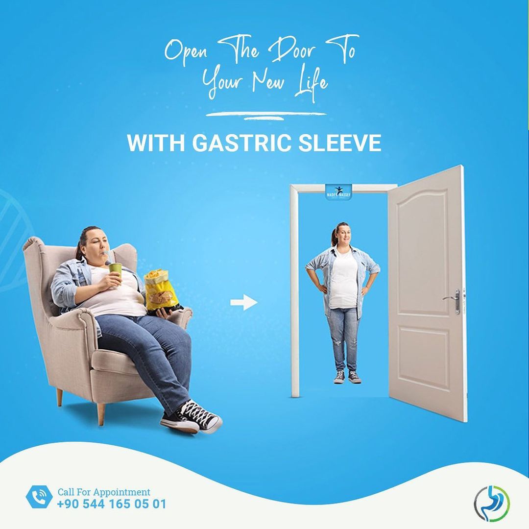 gastric-sleeve-turkey (1)